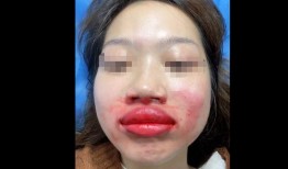 唇部视频在线观看,揭秘热门唇部视频的魅力瞬间