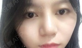 娱乐吃瓜酱不用做鼻子,揭秘明星隐私，不做鼻子也能畅游娱乐圈